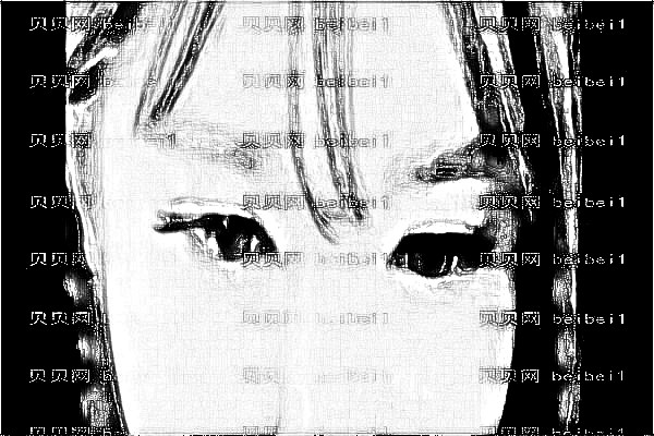 ,山西医科一院激光去痘印做的怎么样【激光去痘印介绍】