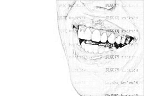 ,山西医科一院牙齿整形较新发布