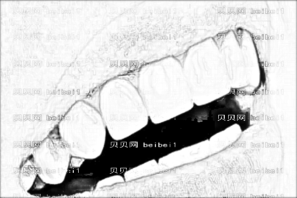 山西省一院牙齿正畸收费标准_医生名单