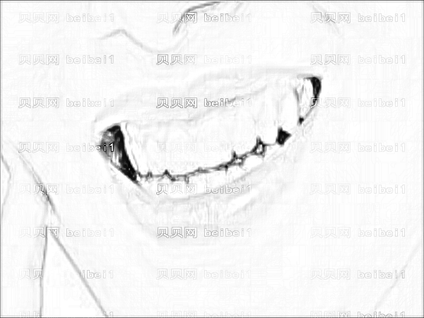 成都华西医院口腔科