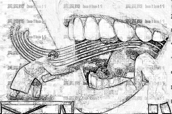 ,郑大一院镶牙口碑怎么样