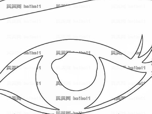 北京八大处宋维铭全切双眼皮+去脂肪怎么样?好不好?【口碑 技术】