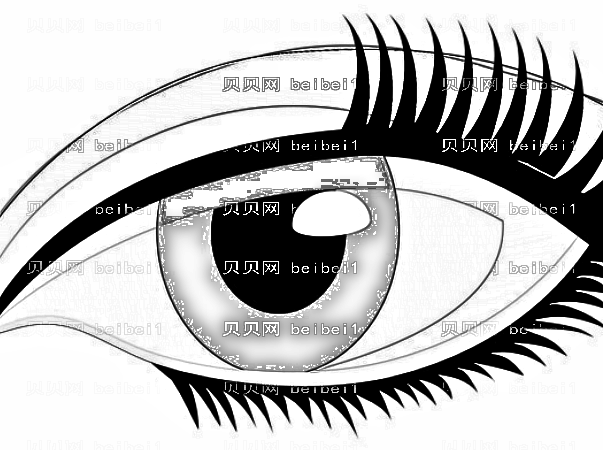 北京八大处宋维铭全切双眼皮+去脂肪怎么样?附手术恢复果一览