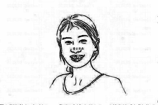 ,阳泉市一院点痣怎么样