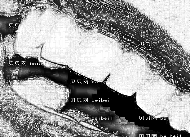 成都贝臣口腔医院牙齿矫正怎么样?价格/费用