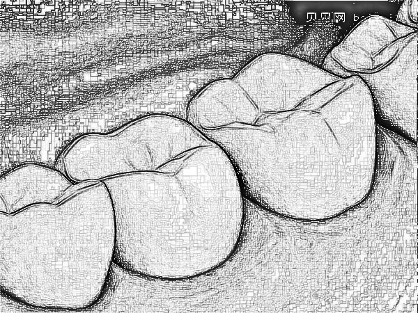 成都贝臣口腔医院做的牙齿矫正怎么样? 请享受术前术后的图