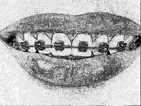 成都博爱口腔医院牙齿矫正哪个医生比较好?介绍PK,多方位!
