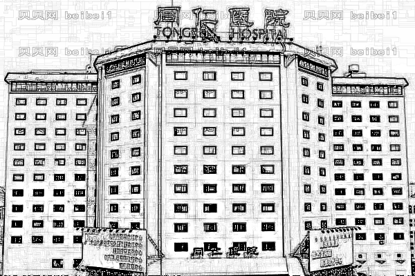 北京同仁医院拉皮多少钱_做的怎么样
