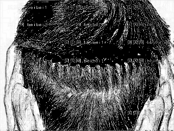 南方医科大学南方医院的苗勇脱发植发多少钱?怎么样?好吗?