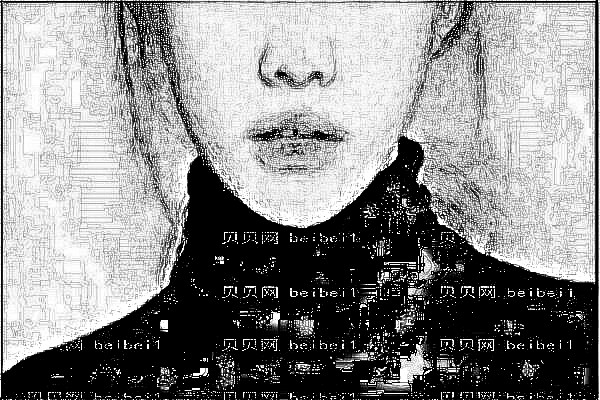 河北中医学院附属医院激光去痣怎么样
