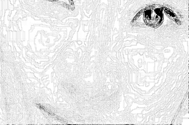 重庆西南医院祛斑做的好不好【祛斑介绍分享】