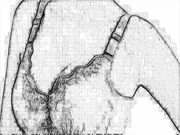 中国医学科学院整形医院(八大处)穆大力内窥镜假体隆胸怎么样?医院实力介绍+口碑医生名单!