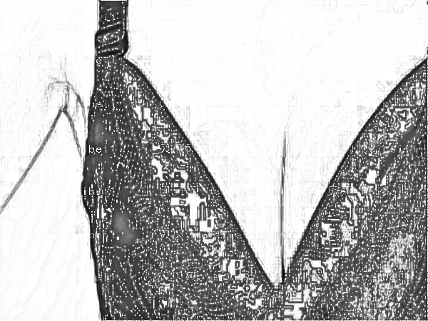 医学科学院整形医院(八大处)穆大力内窥镜假体隆胸哪个专家好?多少钱?