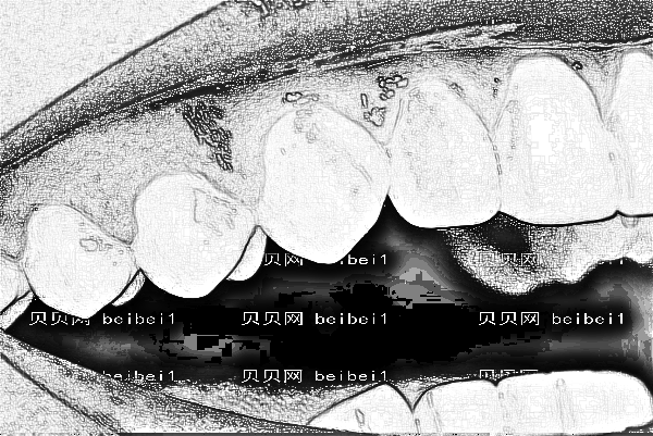 2022重庆西南医院牙科种植牙价格多少_种植牙能维持几年