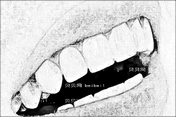 深圳市人民医院牙齿矫正怎么样_哪位医生做得不错