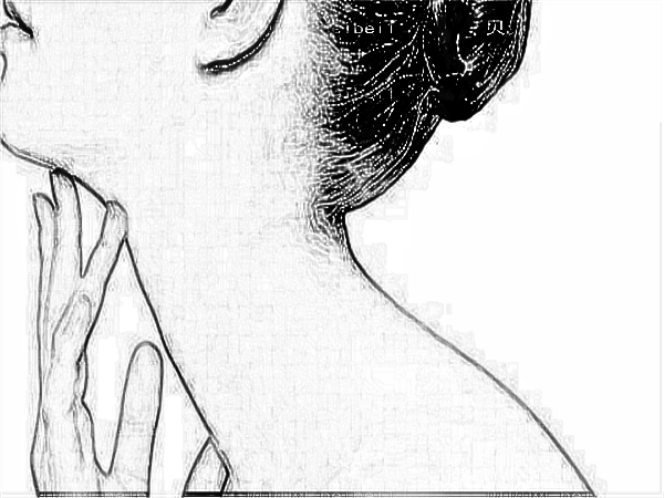 北京协和医院的俞楠泽除皱怎么样?好不好?多少钱?