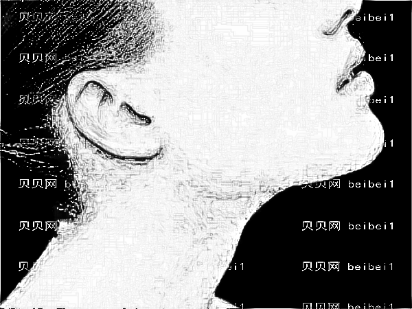 北京协和医院的俞楠泽除皱哪个医生好?果好吗?