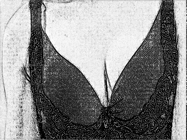 中国医学科学院整形外科刘春军自体脂肪注射隆乳多少钱?【费用、价格】