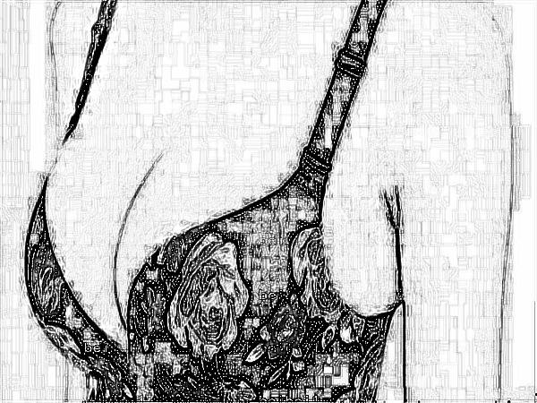 医学科学院整形外科刘春军自体脂肪注射隆乳怎么样?多少钱?