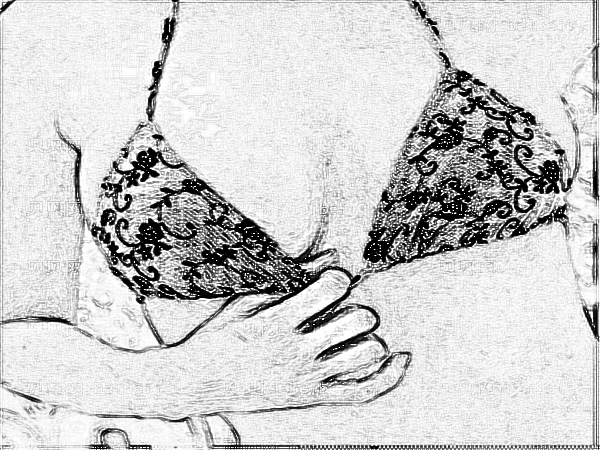 医学科学院整形外科刘春军自体脂肪注射隆乳果好吗？多少钱