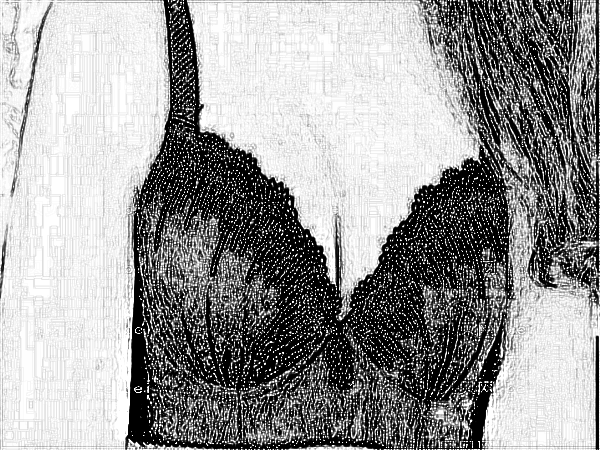 医学科学院整形外科刘春军自体脂肪注射隆乳果好吗？多少钱