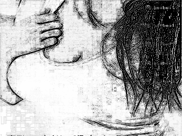 医学科学院整形外科刘春军自体脂肪注射隆乳怎么样?自体脂肪注射隆乳专家+自体脂肪注射隆乳介绍集