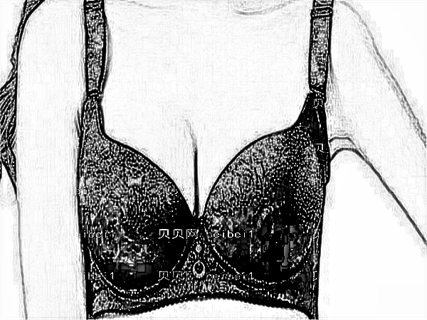 医学科学院整形外科刘春军自体脂肪注射隆乳果怎么样？贵不贵？