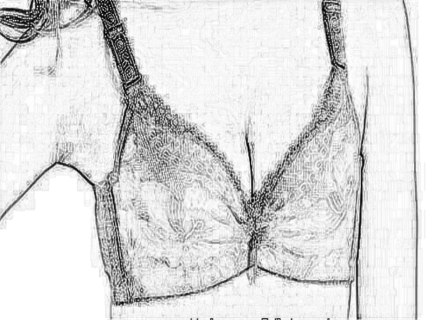 医学科学院整形外科刘春军自体脂肪注射隆乳怎么样？价格/费用