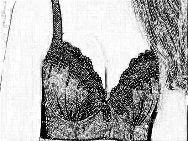 医学科学院整形外科刘春军自体脂肪注射隆乳怎么样？价格/费用