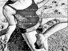 医学科学院整形外科刘春军自体脂肪注射隆乳要多少钱?医学科学院整形外科刘春军客户回答