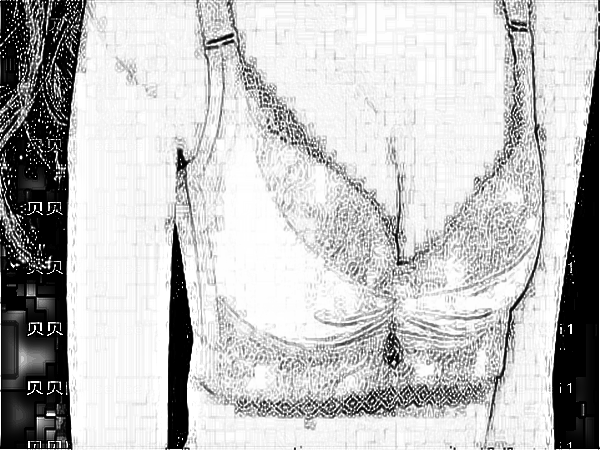 中国医学科学院整形外科刘春军自体脂肪注射隆乳怎么样?有没有失败介绍?