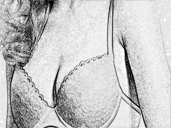 医学科学院整形外科刘春军自体脂肪注射隆乳怎么样?技术好吗?