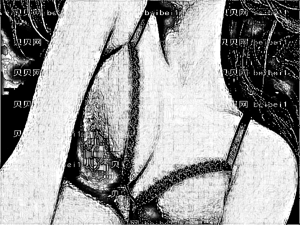 医学科学院整形外科刘春军自体脂肪注射隆乳怎么样?技术好吗?