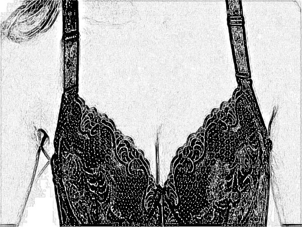 医学科学院整形外科刘春军自体脂肪注射隆乳多少钱?怎么样?介绍