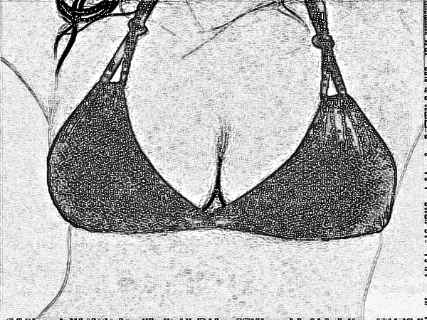 医学科学院整形外科刘春军自体脂肪注射隆乳多少钱?【哪个大夫好】