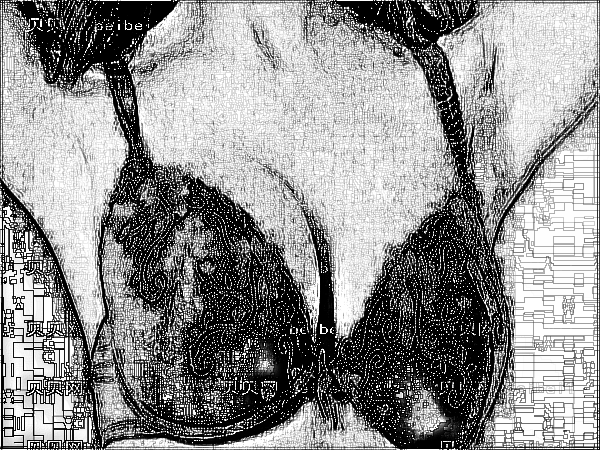 中国医学科学院整形外科刘春军自体脂肪注射隆乳·介绍分享