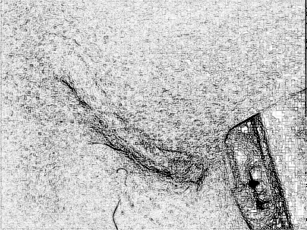 八大处疤痕去除王连召多少钱?【费用、价格】