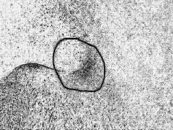 八大处疤痕去除王连召多少钱?【费用、价格】