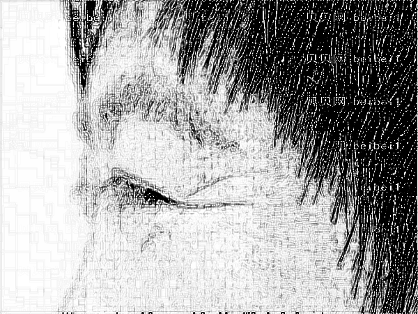 上海第九人民医院玻尿酸注射杨娴娴多少钱?哪个医生专业?【技术、口碑】