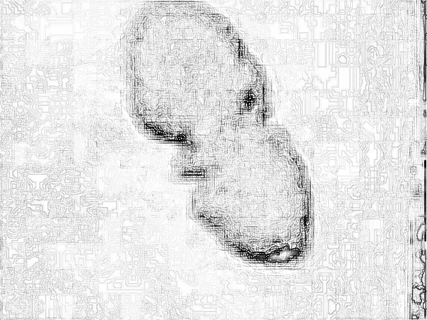 八大处疤痕去除王连召价格多少钱?做的果怎么样?