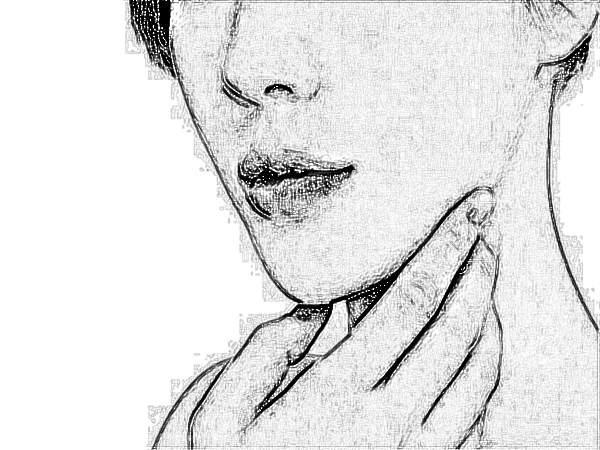 【合肥恒美整形医院热玛吉价格】_费用_多少钱