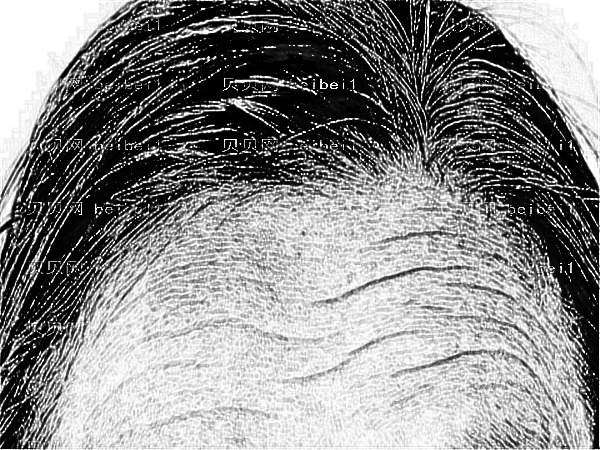 北京华韩整形医院热玛吉除皱多少钱?怎么样?好吗?