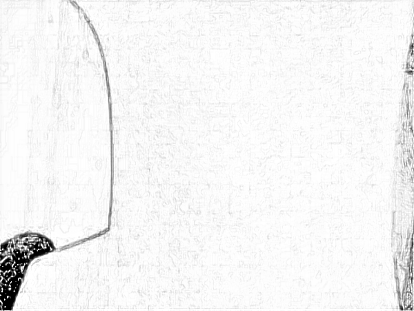上海伯思立医疗美容热玛吉除皱怎么样?附手术恢复果一览