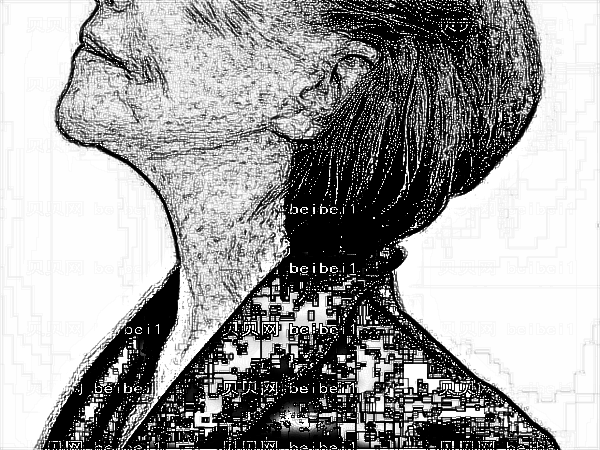 北京安加医疗部热玛吉除皱好吗?