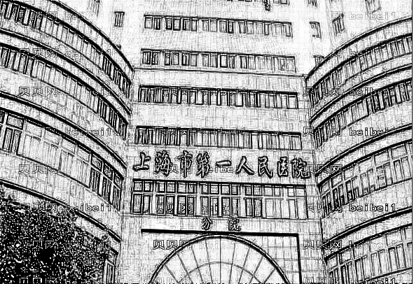 上海市第一人民医院全飞秒做的怎么样？哪位医生做得好