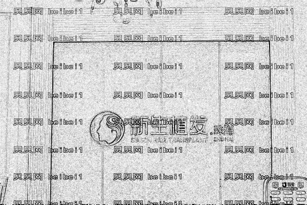 2022珠海五大植发医院排名一览!各有各的实力