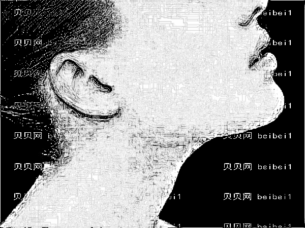 北京华韩整形医院热玛吉除皱技术好吗?附热玛吉除皱前后