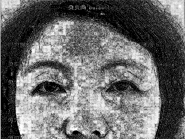 北京华韩整形医院热玛吉除皱技术好吗?附热玛吉除皱前后