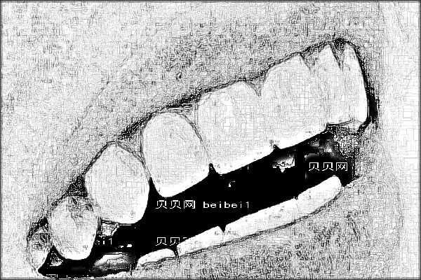南通市第一人民医院牙科怎么收费_医生名单介绍