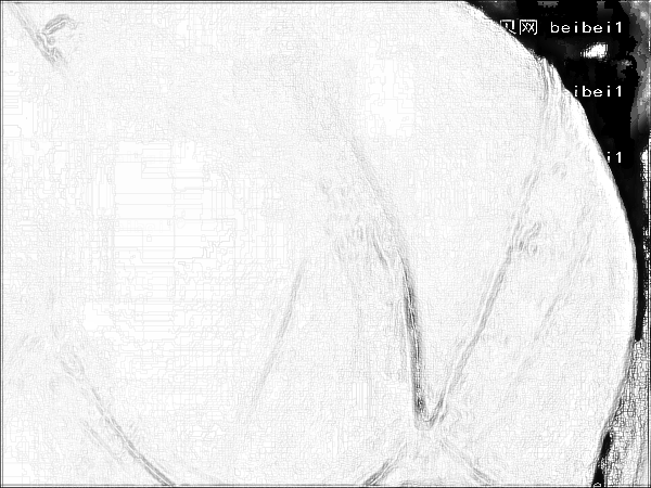 2022温州隆胸失败修复整形医院介绍前三名单汇总!宝藏机构